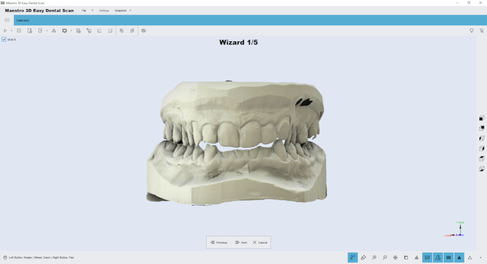 Maestro3d.easy.dental.scan.wizard.ortho2.png