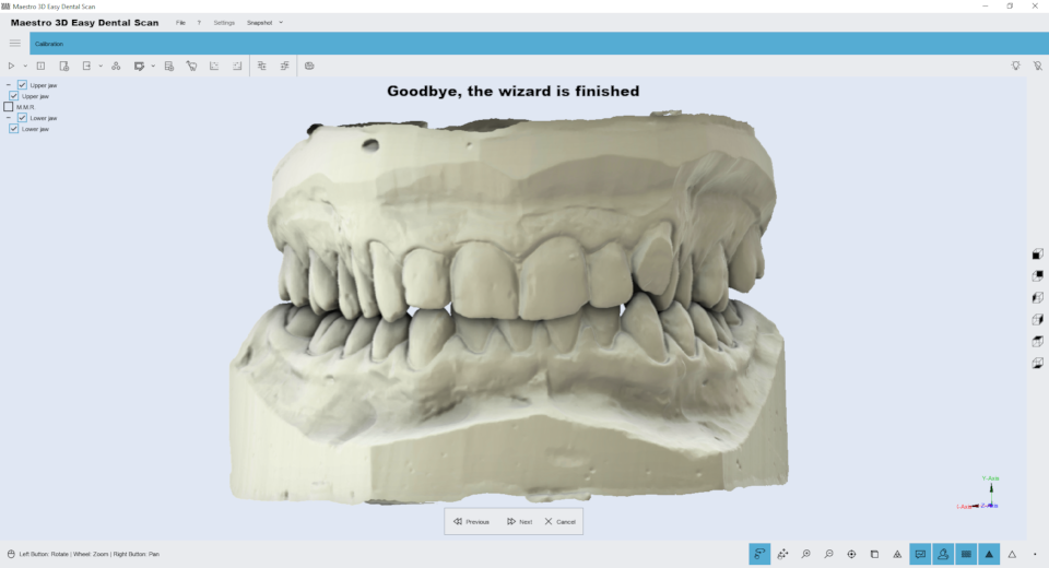 Maestro3d.easy.dental.scan.wizard.ortho5.png