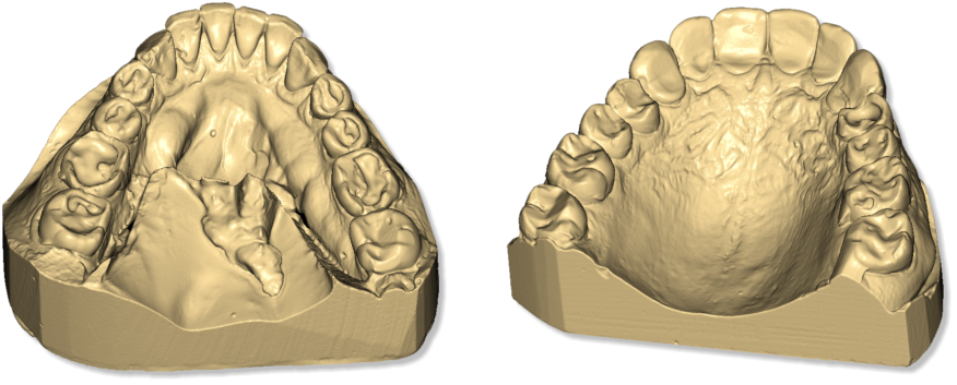 Maestro3D.Easy.Dental.Scan.taget.object.upper.lower.jaw.png