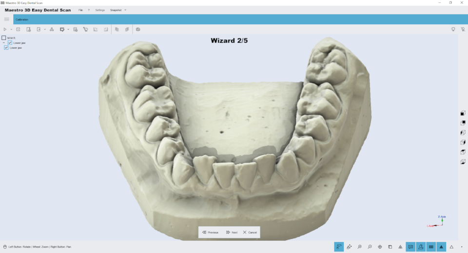 Maestro3d.easy.dental.scan.wizard.ortho3.png