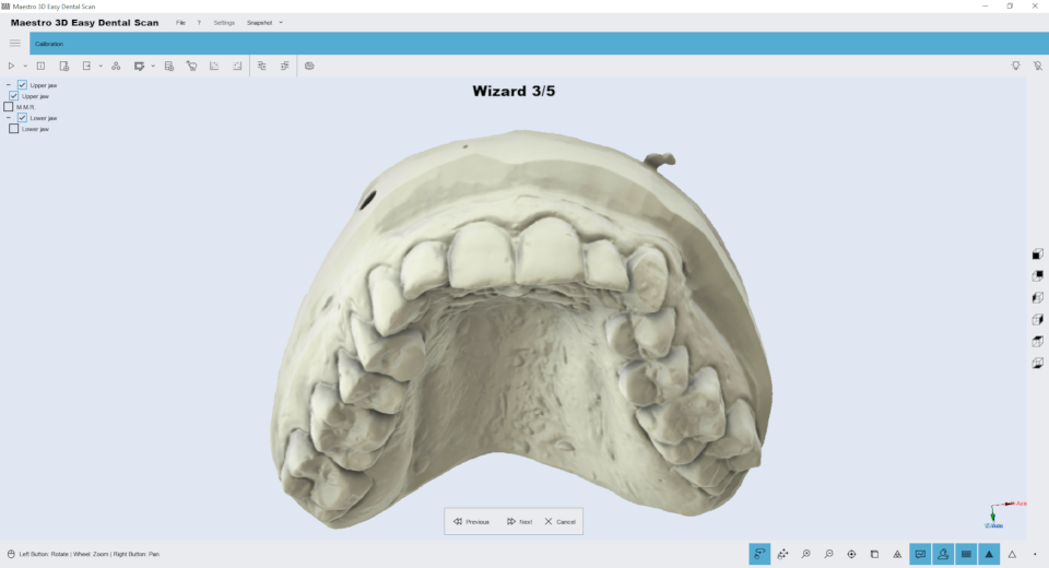 Maestro3d.easy.dental.scan.wizard.ortho4.png