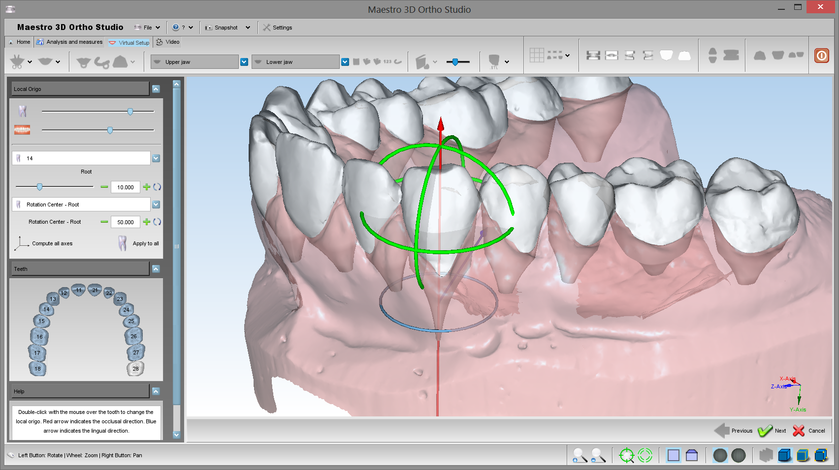 CAD cam системы в ортодонтии