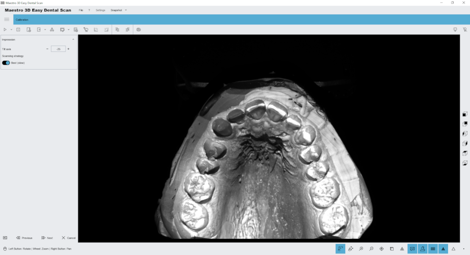 Maestro.3D.Easy.Dental.Scan.smart.impression.scanning.system step01.png