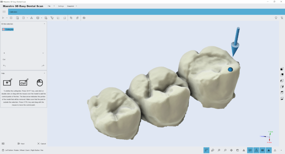 Maestro3d.easy.dental.scan.edit.with.polyline2.png