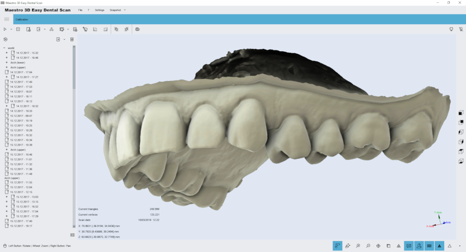 Maestro.3D.Easy.Dental.Scan.smart.impression.scanning.system step05 result 2.png