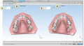 Maestro3d.dental.studio.3D.compare2.png