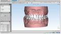 Maestro3d.dental.studio.virtual.setup2.png
