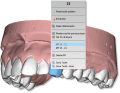 Maestro3d.dental.studio.virtual.setup.IPR1.png