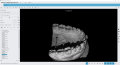 Maestro3d.easy.dental.scan.scan.strategy1.png