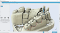 Maestro3d.easy.dental.scan.edit.with.polyline1.png